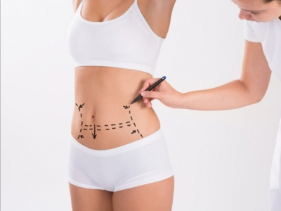 Мифы и реальность пластической хирургии: Почему не стоит доверять методам Юрия Джндояна